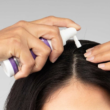 Foligain Treatment for Thinning Hair for Women - 59 ml